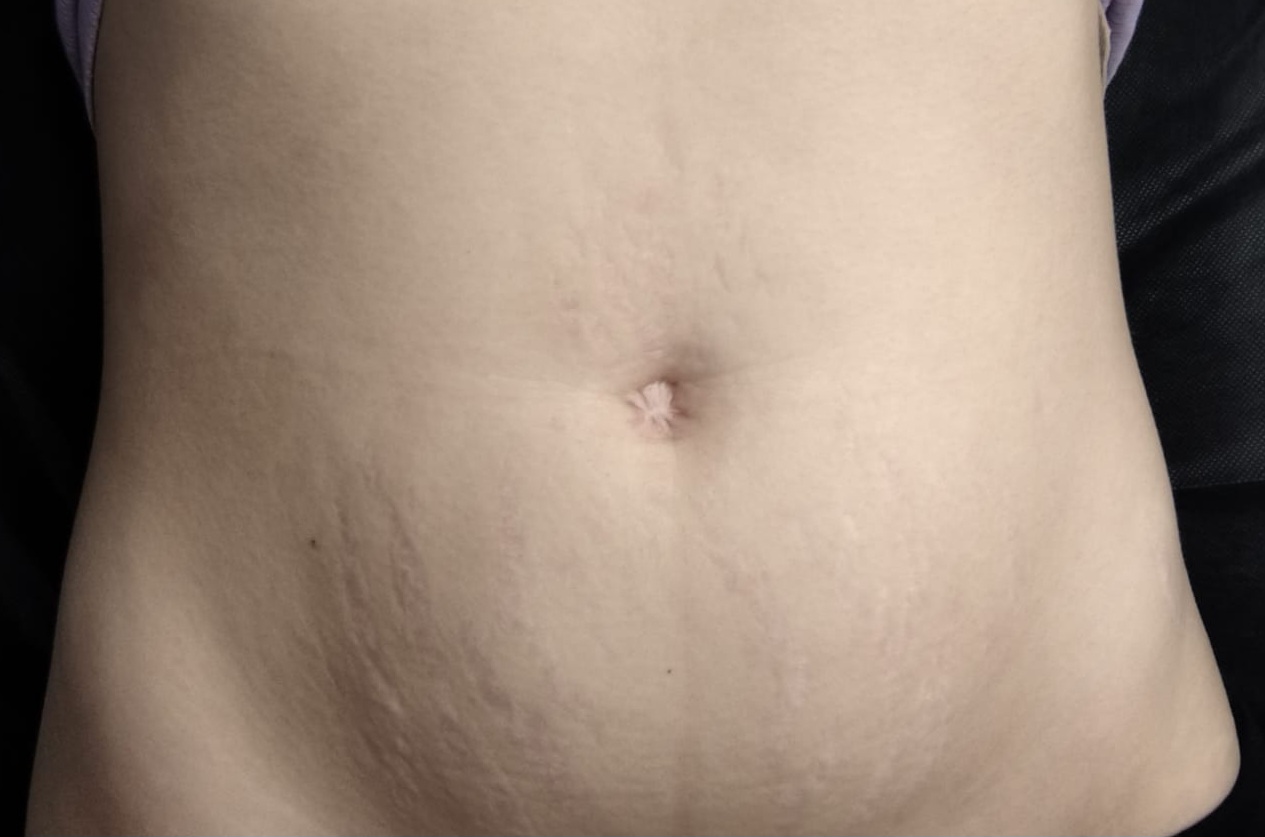 IMG-20250210-WA0009(1)