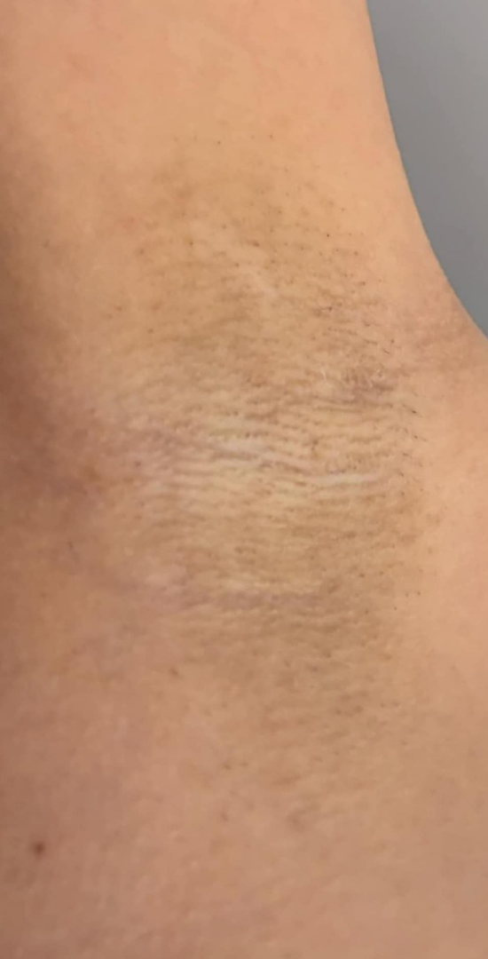 20250310_223945_0000