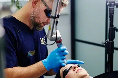 Laserowe usuwanie PMU/TATTO